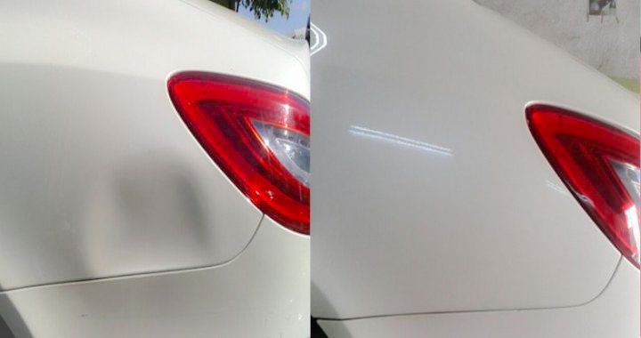 Göçük Düzeltme (PDR)